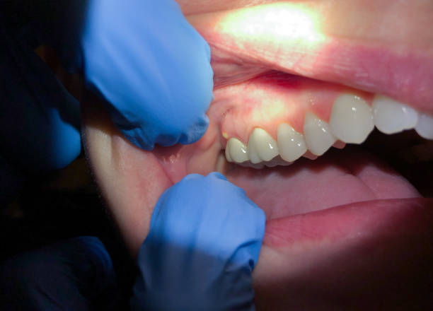 Best Cosmetic Emergency Dentistry in Richville, OH
